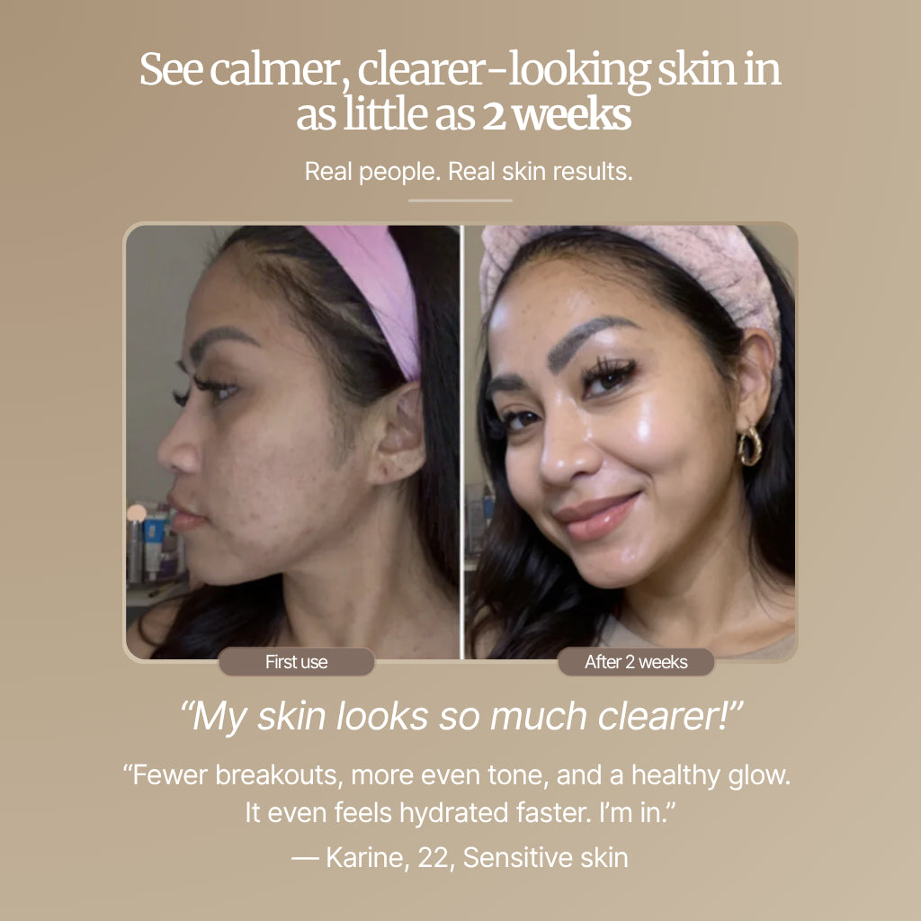 Spray NoCrave to silence the sweet and control your cravings